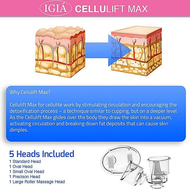 Cellulift Max Cellulite Reducing Suction Vacuum Massager Beauty Tools, , alternate image number null