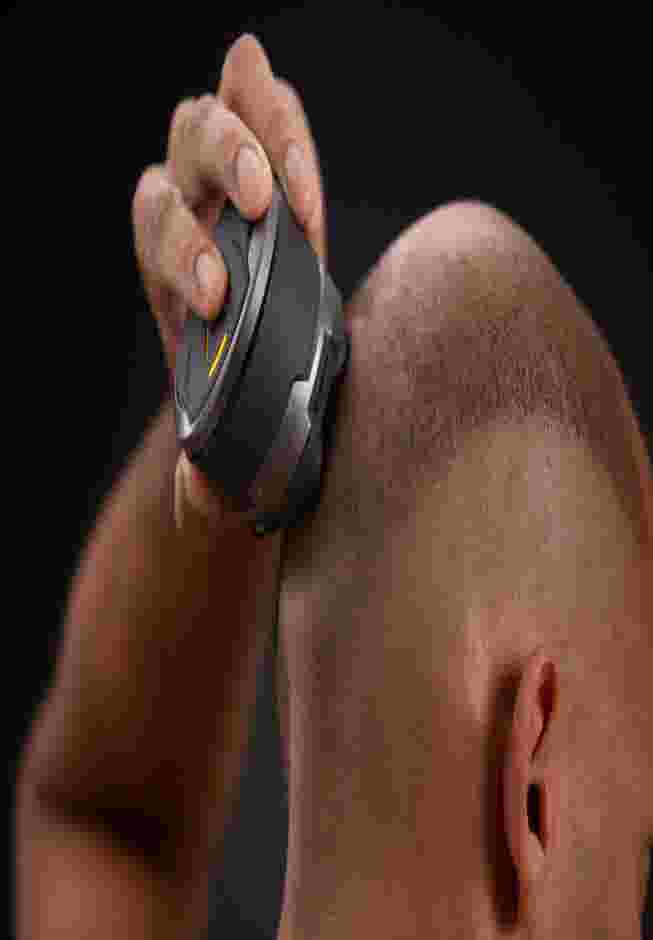 Microtouch Titanium® Electric Head and Face Shaver image number 1